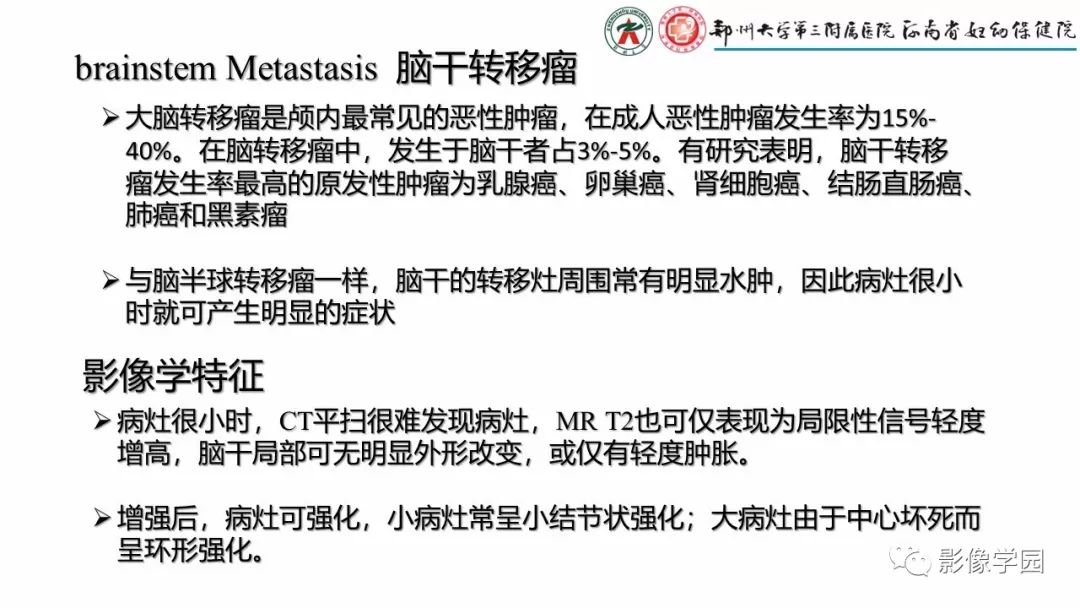 【PPT】脑干病变的影像学表现-11