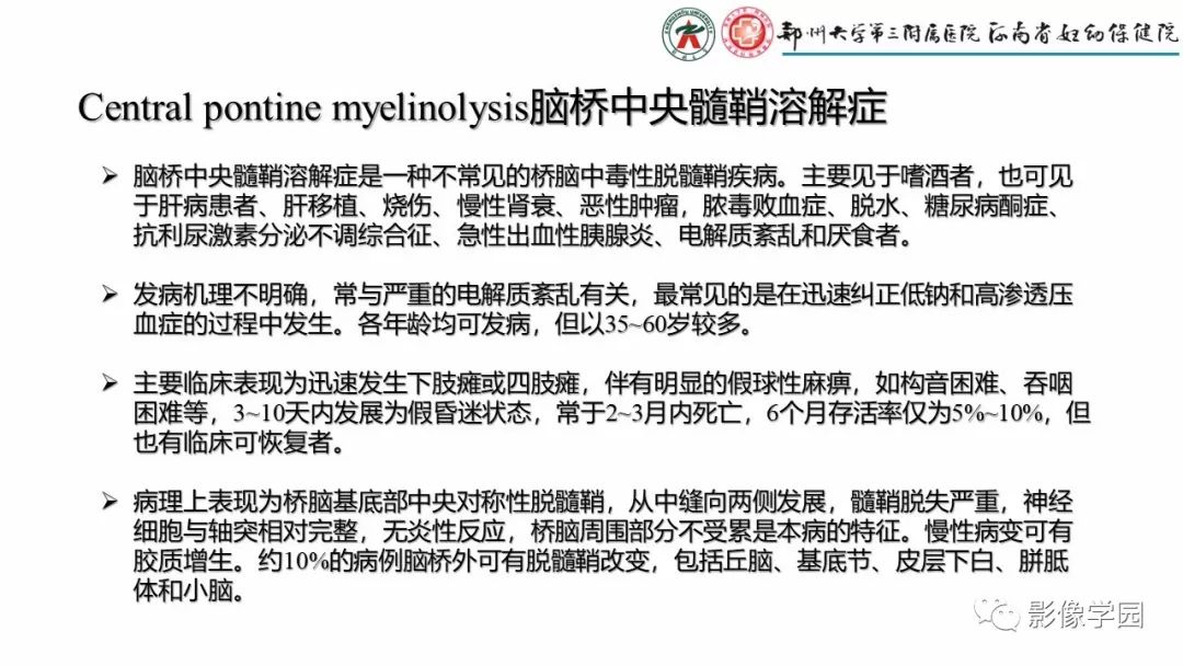 【PPT】脑干病变的影像学表现-25