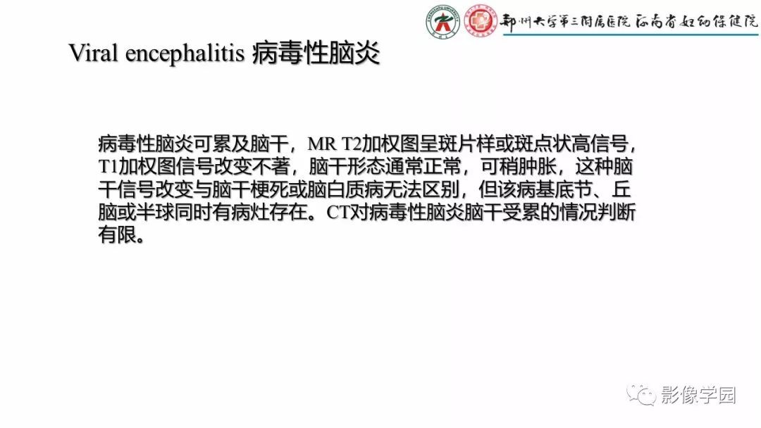 【PPT】脑干病变的影像学表现-23