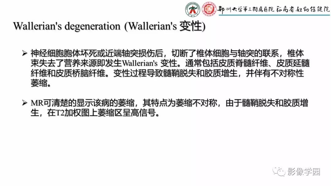 【PPT】脑干病变的影像学表现-33