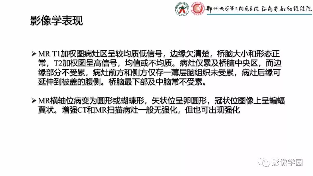 【PPT】脑干病变的影像学表现-26