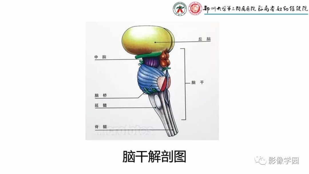 【PPT】脑干病变的影像学表现-3