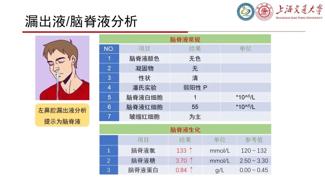 【病例】脑脊液耳漏1例CT及MR病例讨论-5