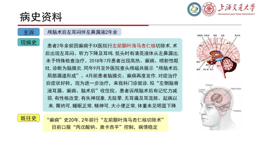 【病例】脑脊液耳漏1例CT及MR病例讨论-2