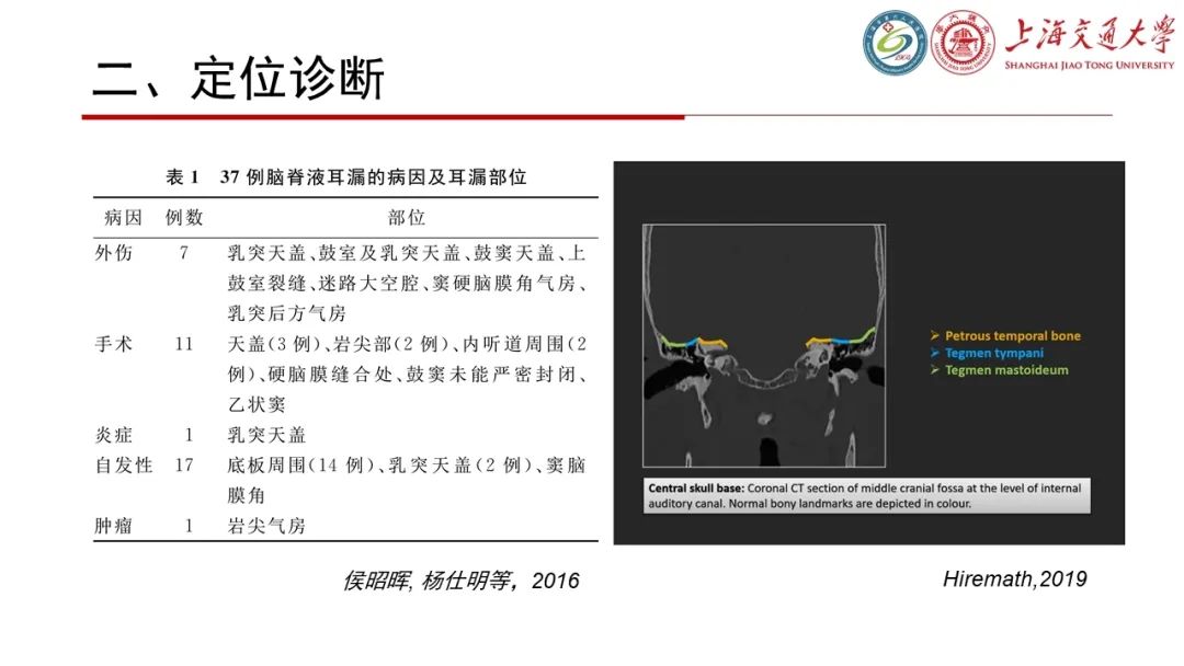 【病例】脑脊液耳漏1例CT及MR病例讨论-17