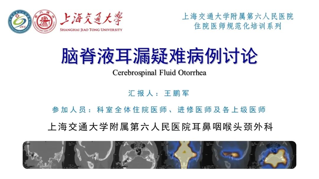 脑脊液耳漏1例CT及MR病例讨论