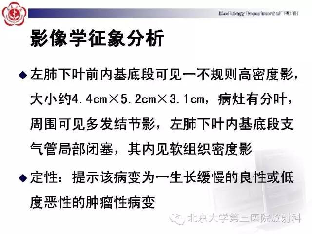 【病例】高分化胎儿型肺腺瘤1例CT