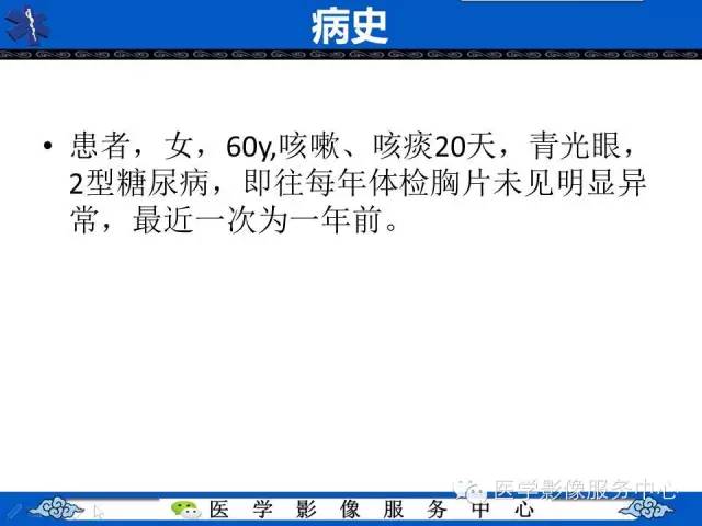 胸膜孤立性纤维瘤1例CT影像表现与鉴别
