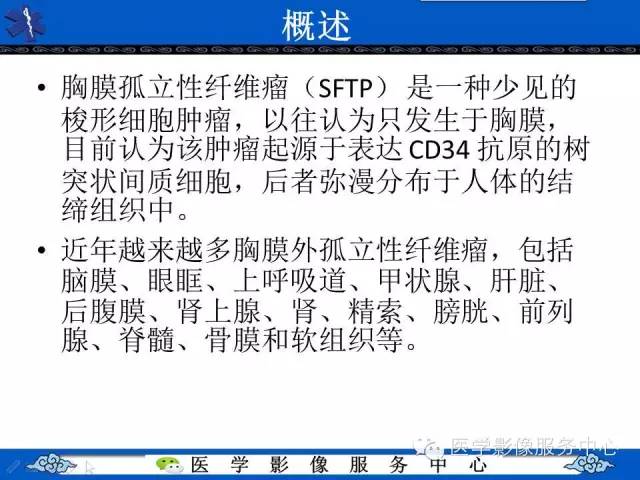 【病例】胸膜孤立性纤维瘤1例CT影像表现与鉴别