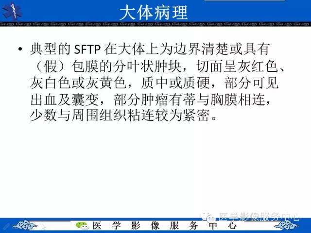 【病例】胸膜孤立性纤维瘤1例CT影像表现与鉴别
