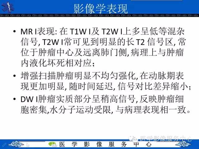 【病例】胸膜孤立性纤维瘤1例CT影像表现与鉴别
