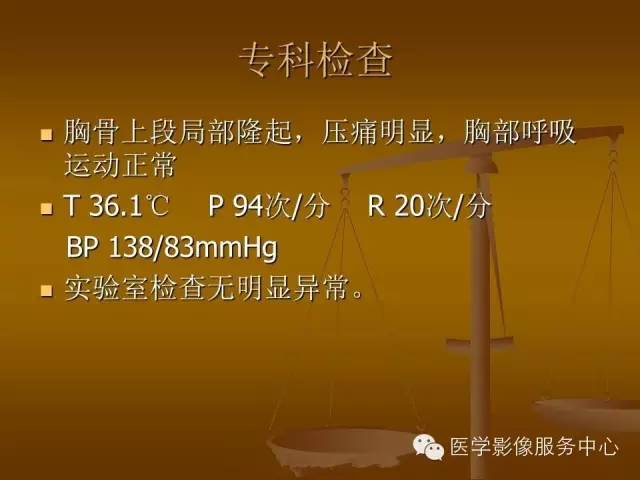 【病例】胸骨浆细胞骨髓瘤1例CT影像表现
