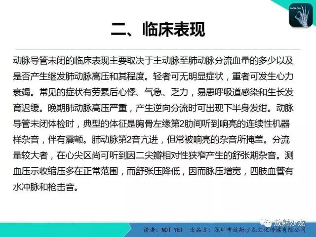 【病例】动脉导管未闭1例CT影像表现