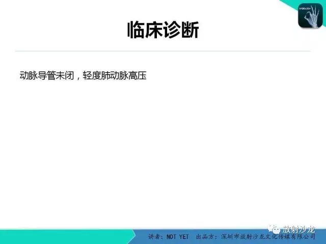 【病例】动脉导管未闭1例CT影像表现