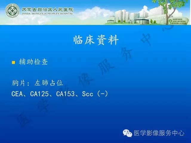 【病例】肺叶间血管淋巴管瘤1例CT