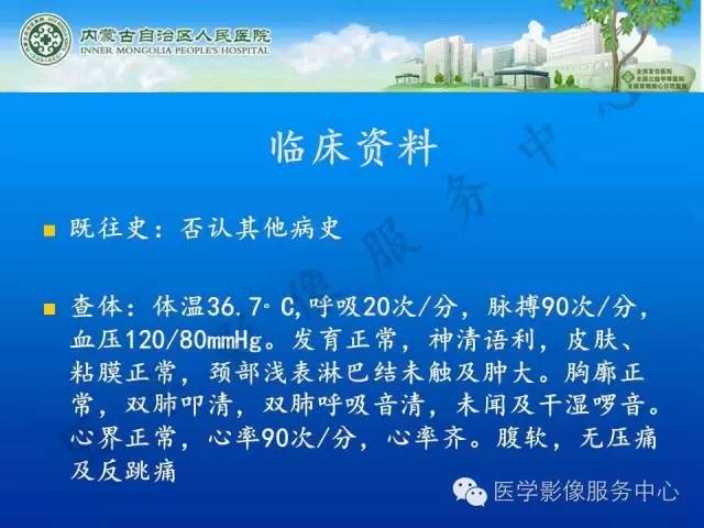 【病例】肺叶间血管淋巴管瘤1例CT