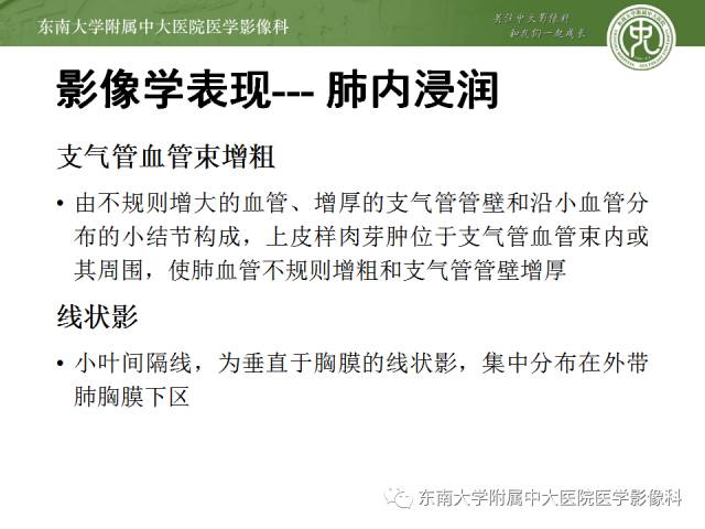 【病例】结节病1例CT