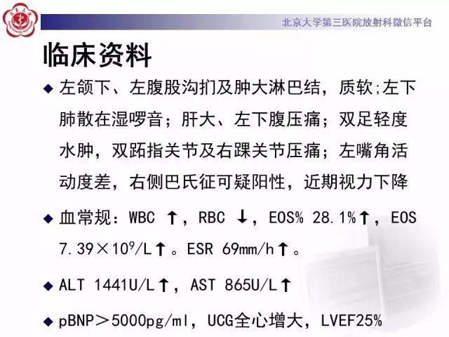 【病例】变应性肉芽肿性多血管炎1例CT