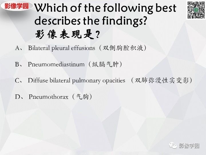 【双语病例】肺泡蛋白沉积症PAP一例CT 【双语病例】肺泡蛋白沉积症PAP一例CT
