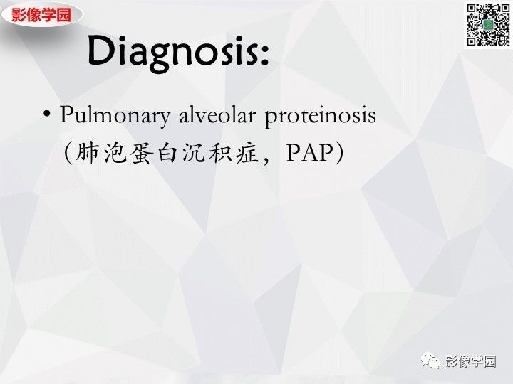 【双语病例】肺泡蛋白沉积症PAP一例CT 【双语病例】肺泡蛋白沉积症PAP一例CT