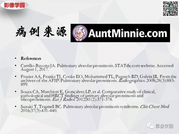 【双语病例】肺泡蛋白沉积症PAP一例CT 【双语病例】肺泡蛋白沉积症PAP一例CT