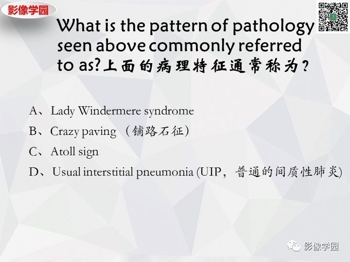 【双语病例】肺泡蛋白沉积症PAP一例CT 【双语病例】肺泡蛋白沉积症PAP一例CT