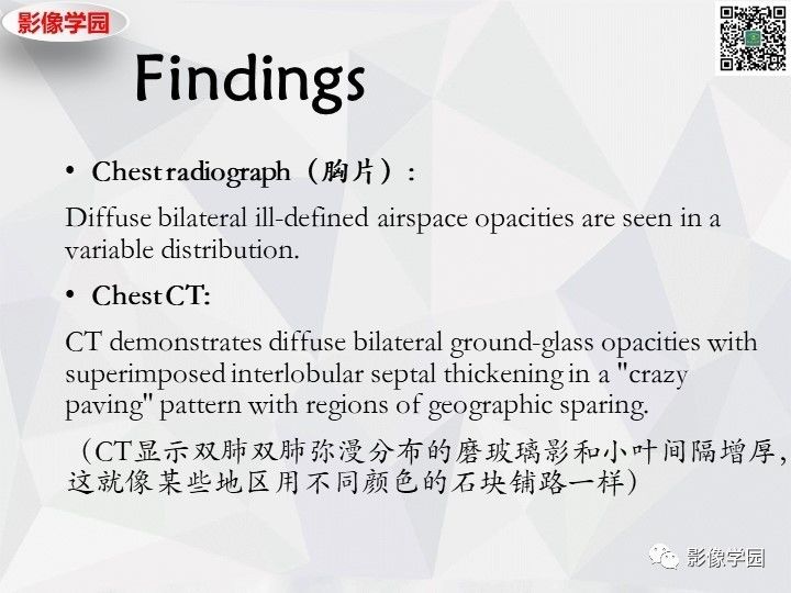 【双语病例】肺泡蛋白沉积症PAP一例CT 【双语病例】肺泡蛋白沉积症PAP一例CT