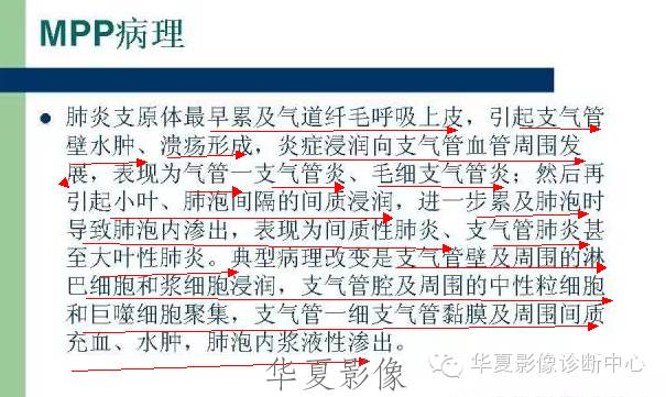 【病例】支原体肺炎1例CT影像表现