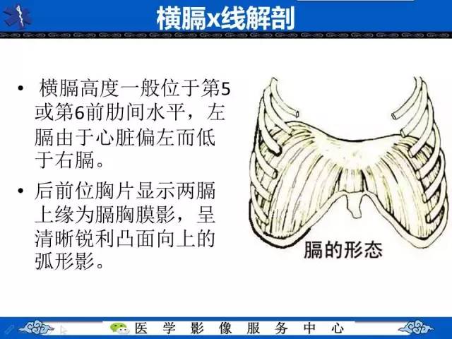 【影像征象】圆锥面包征——膈肌破裂