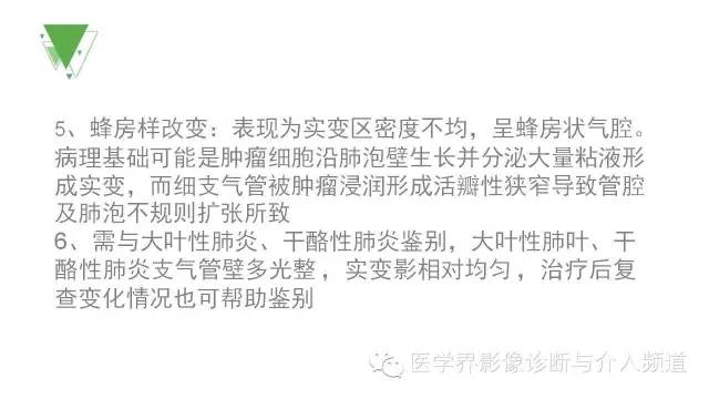 【PPT】细支气管肺泡肺癌的CT诊断