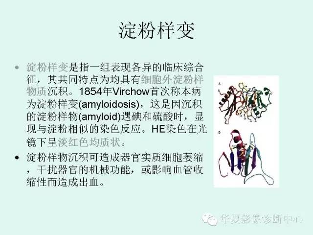 【病例】肺淀粉样变性1例CT影像表现