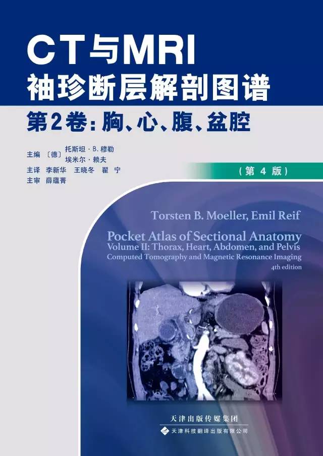 胸部CT袖珍断层解剖图谱