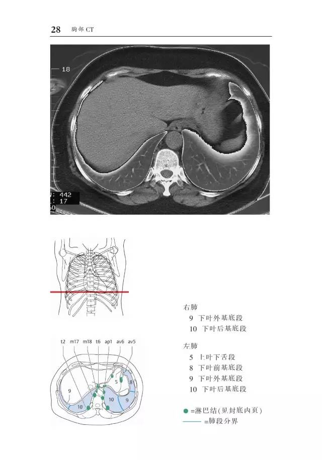 胸部CT袖珍断层解剖图谱