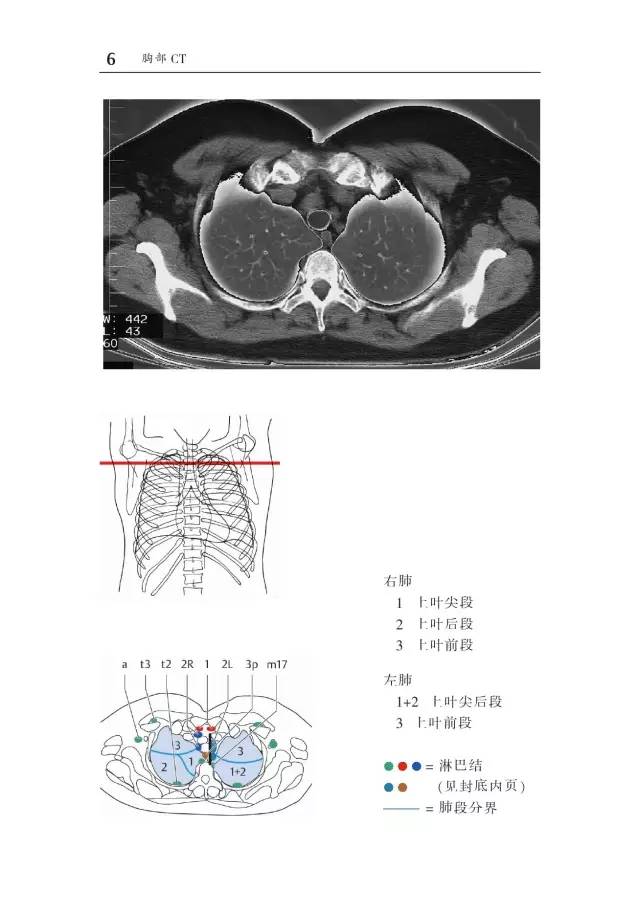 胸部CT袖珍断层解剖图谱