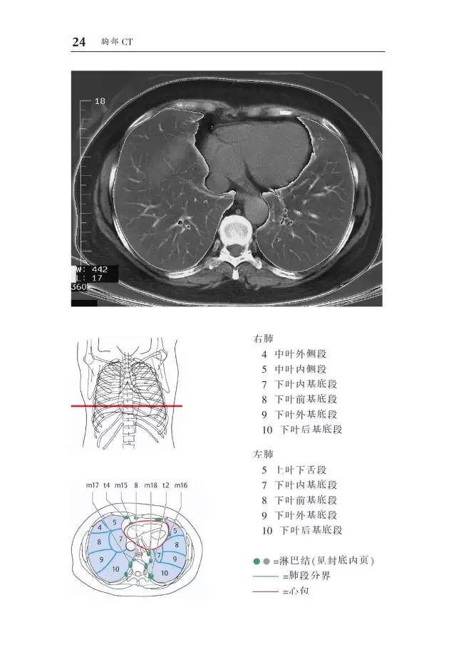 胸部CT袖珍断层解剖图谱