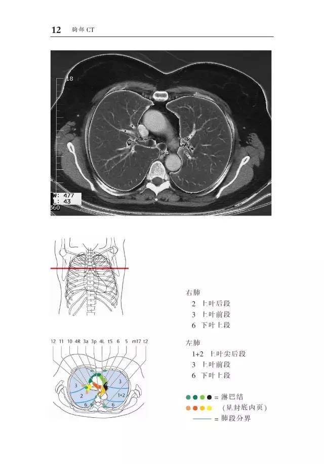 胸部CT袖珍断层解剖图谱
