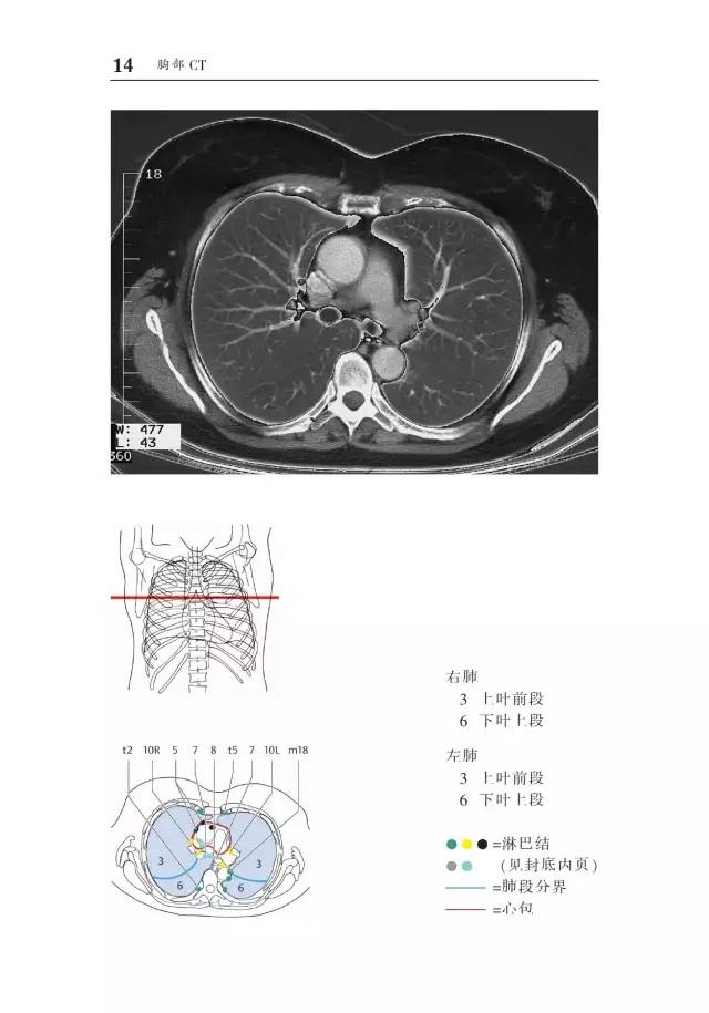 胸部CT袖珍断层解剖图谱