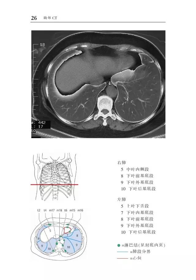 胸部CT袖珍断层解剖图谱