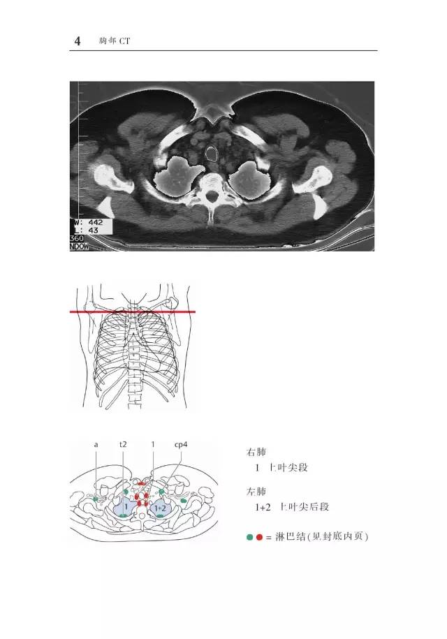 胸部CT袖珍断层解剖图谱