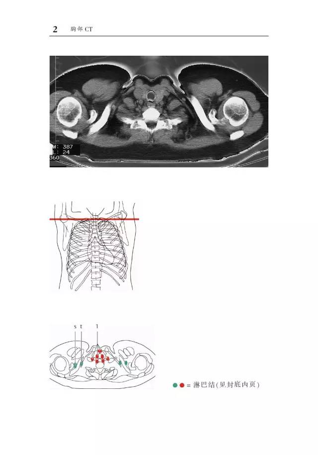 胸部CT袖珍断层解剖图谱