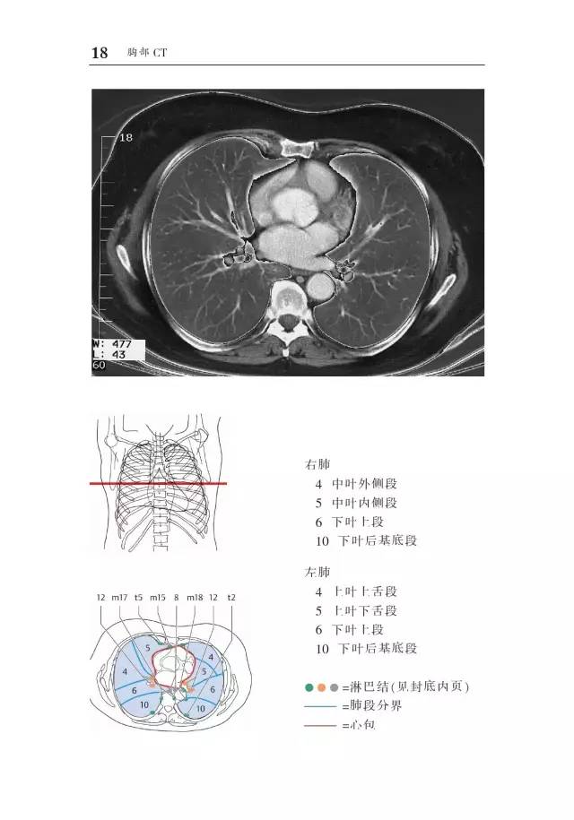 胸部CT袖珍断层解剖图谱