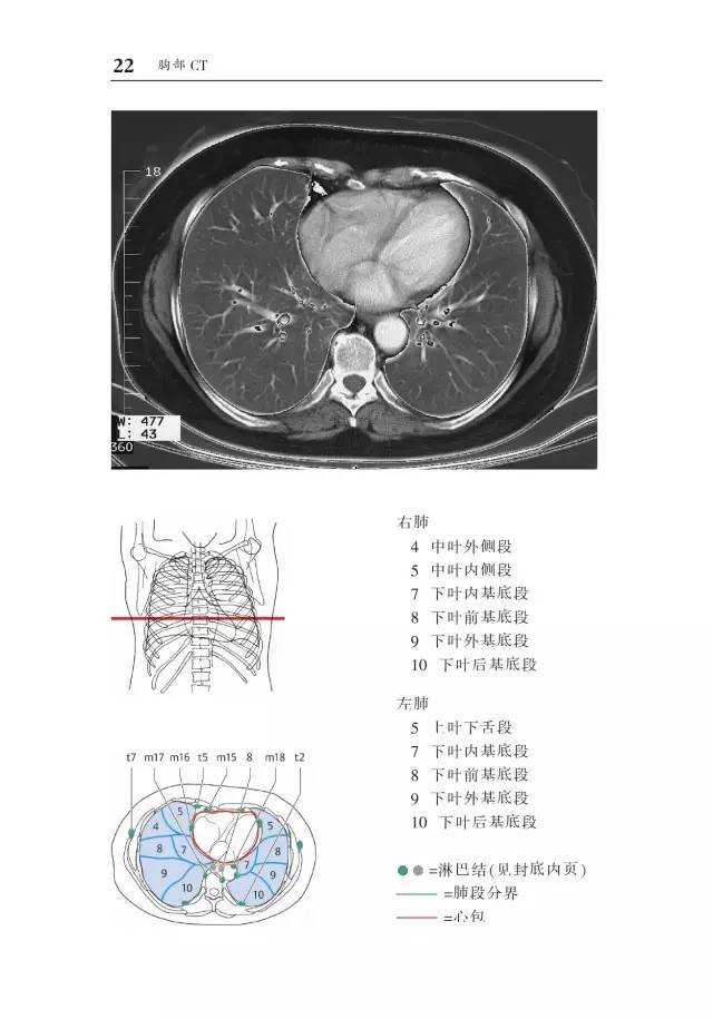 胸部CT袖珍断层解剖图谱