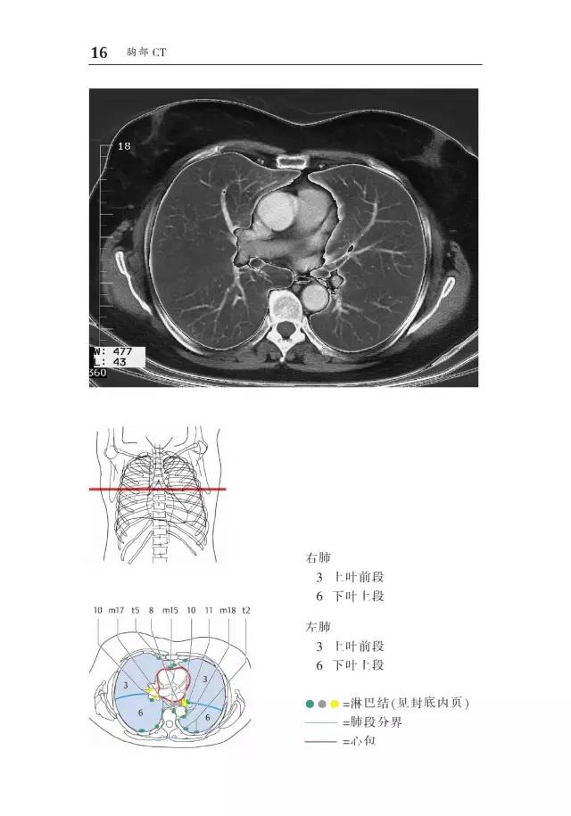 胸部CT袖珍断层解剖图谱