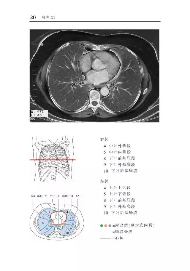胸部CT袖珍断层解剖图谱