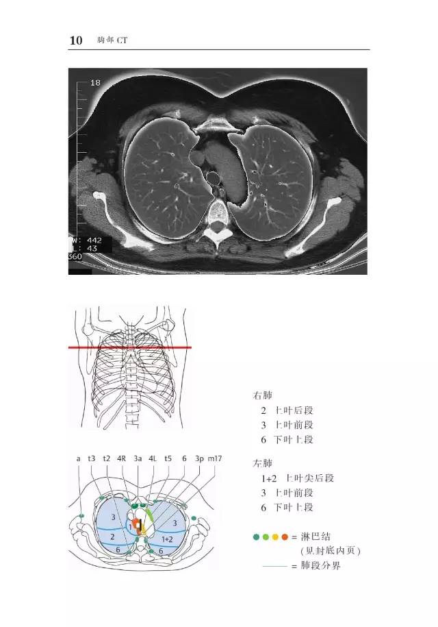 胸部CT袖珍断层解剖图谱