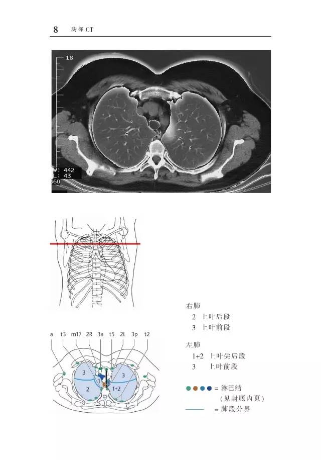 胸部CT袖珍断层解剖图谱