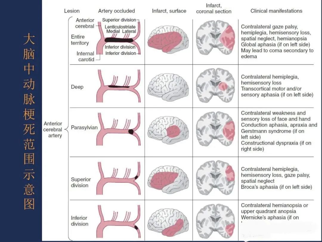 从梗死部位推测责任血管：脑血管解剖-34