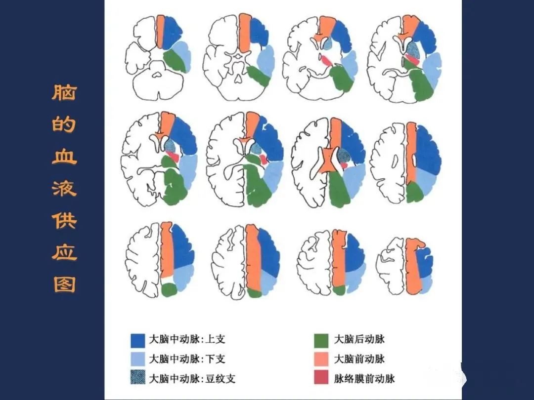 从梗死部位推测责任血管：脑血管解剖-8
