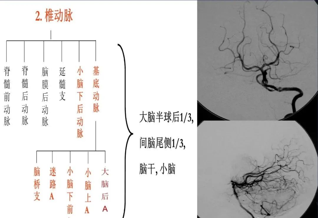 从梗死部位推测责任血管：脑血管解剖-4