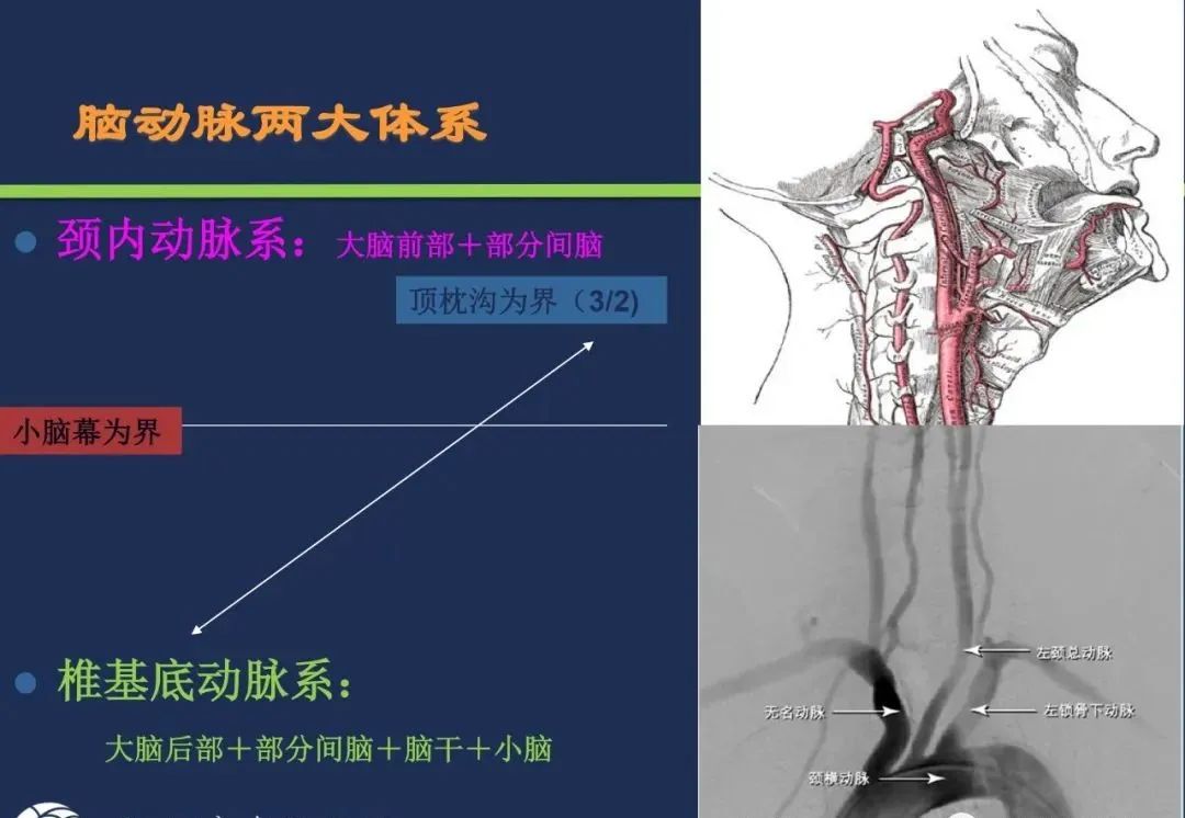 从梗死部位推测责任血管：脑血管解剖-2